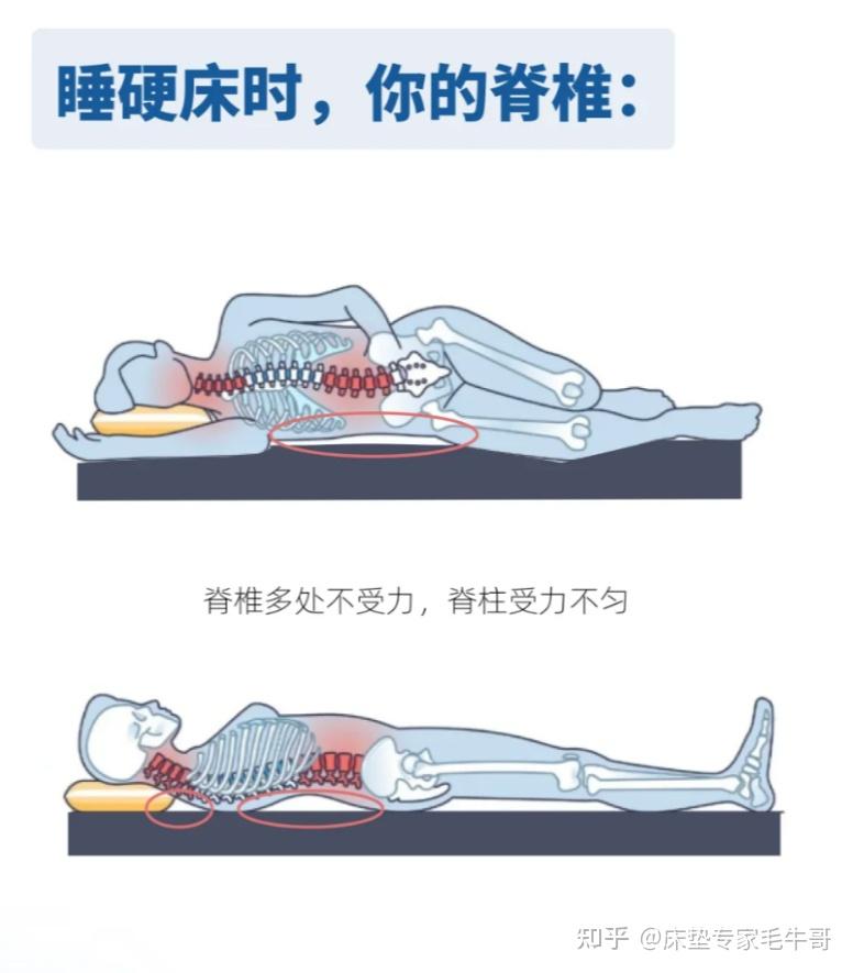 医生建议“腰疼要睡硬床”，但真相可能与你认为的大相径 - 知乎