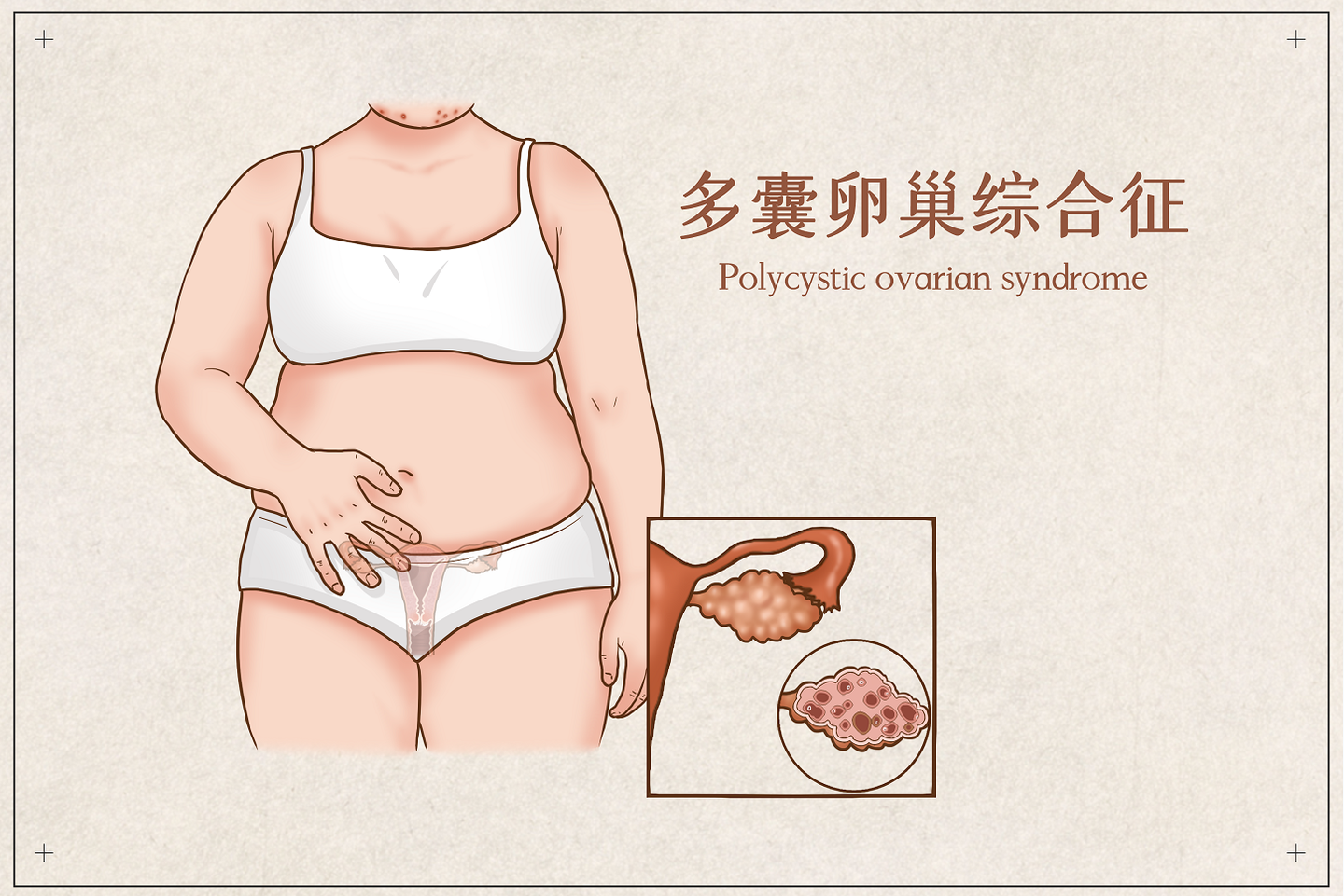 v2-5a998828231dcc0c5d1e4f1da086b371_1440w.jpg?source=172ae18b