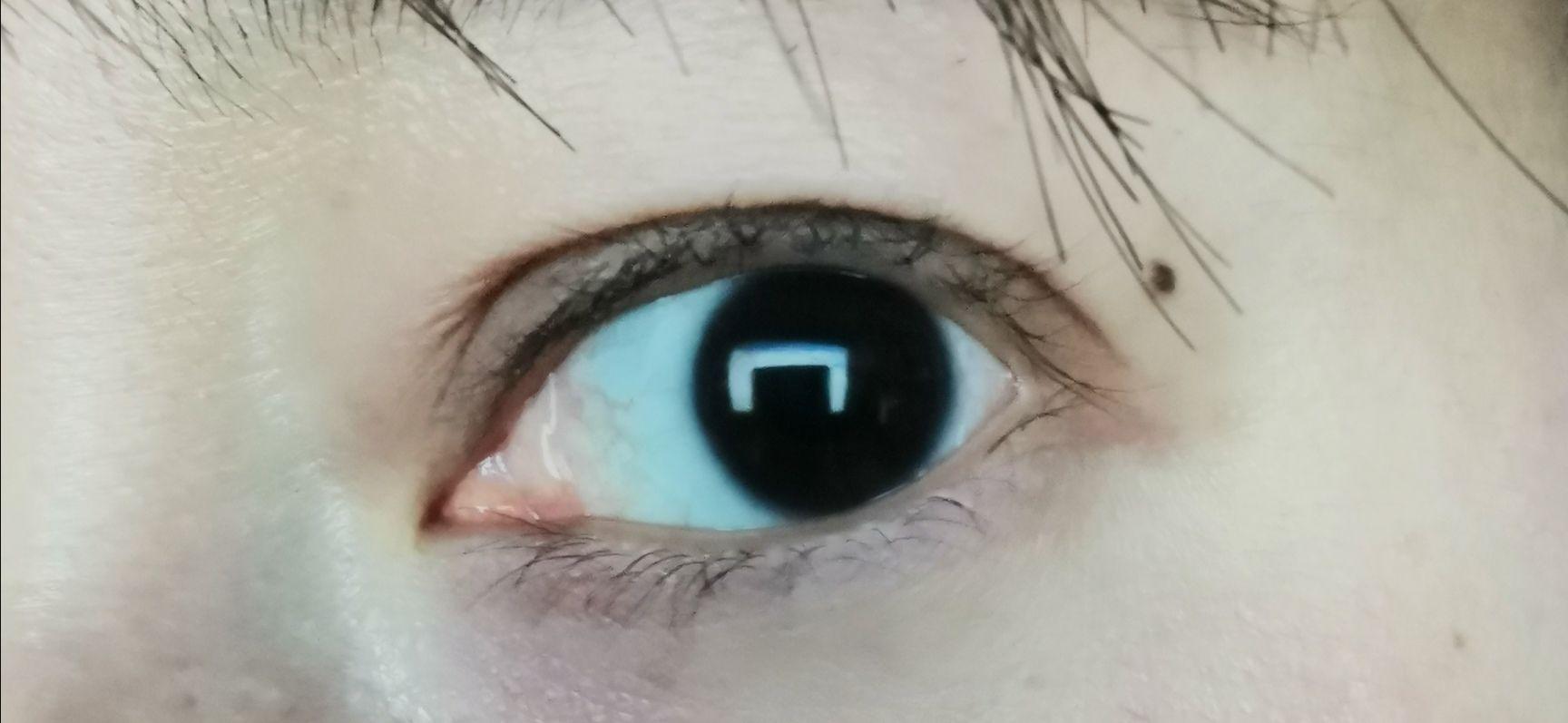 拥有不寻常的虹膜是种怎样的体验?