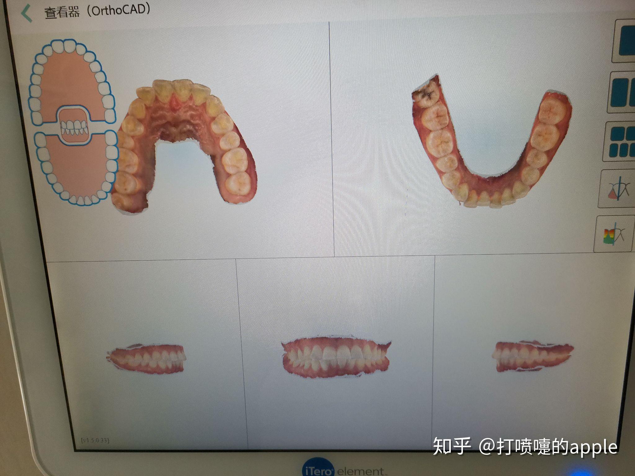 v2-5ad704a8714fef527ed63d92ea5b7619_r.jpg