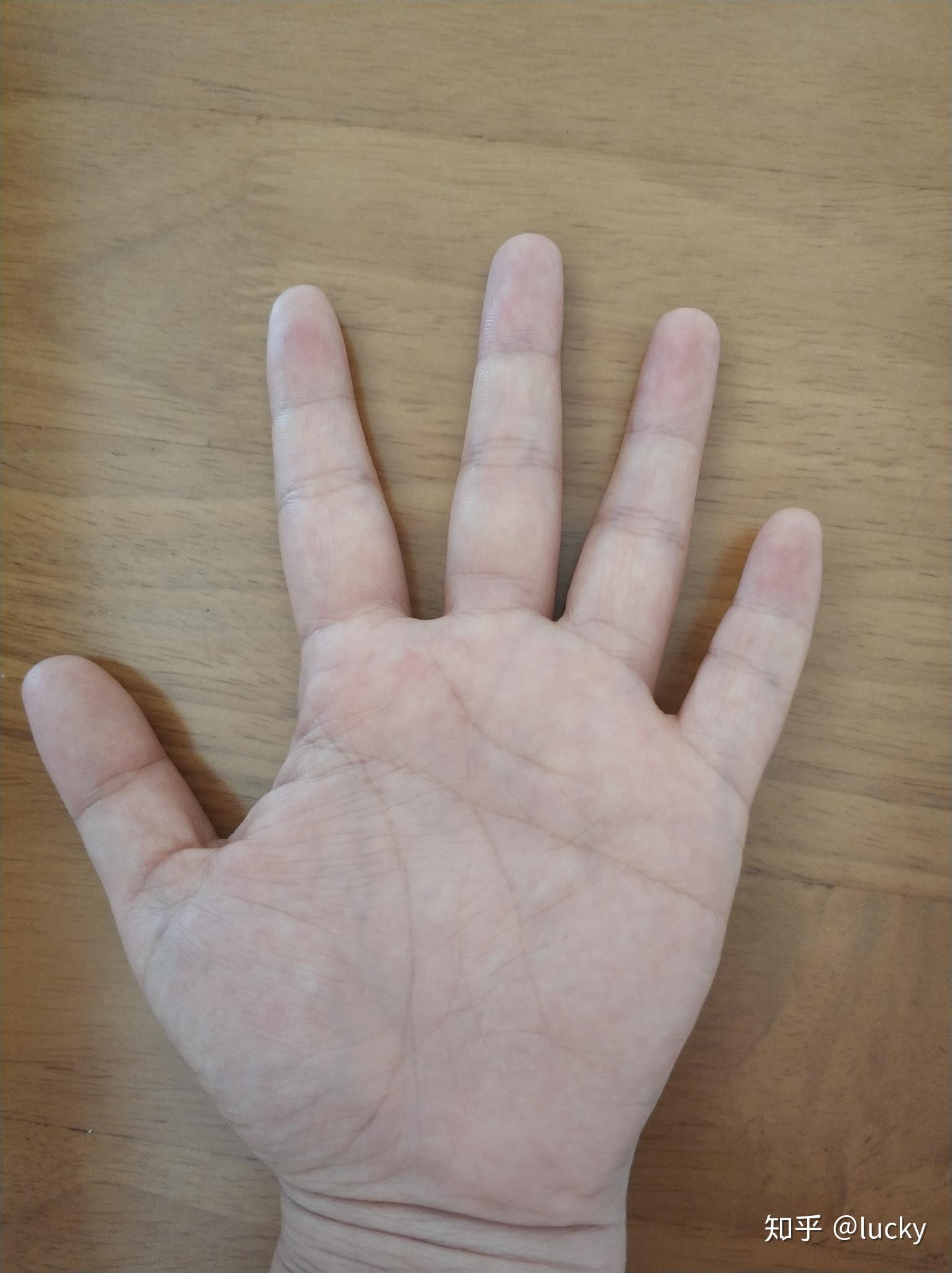 手指粗肉多小指短按和弦老碰弦适合弹吉他吗