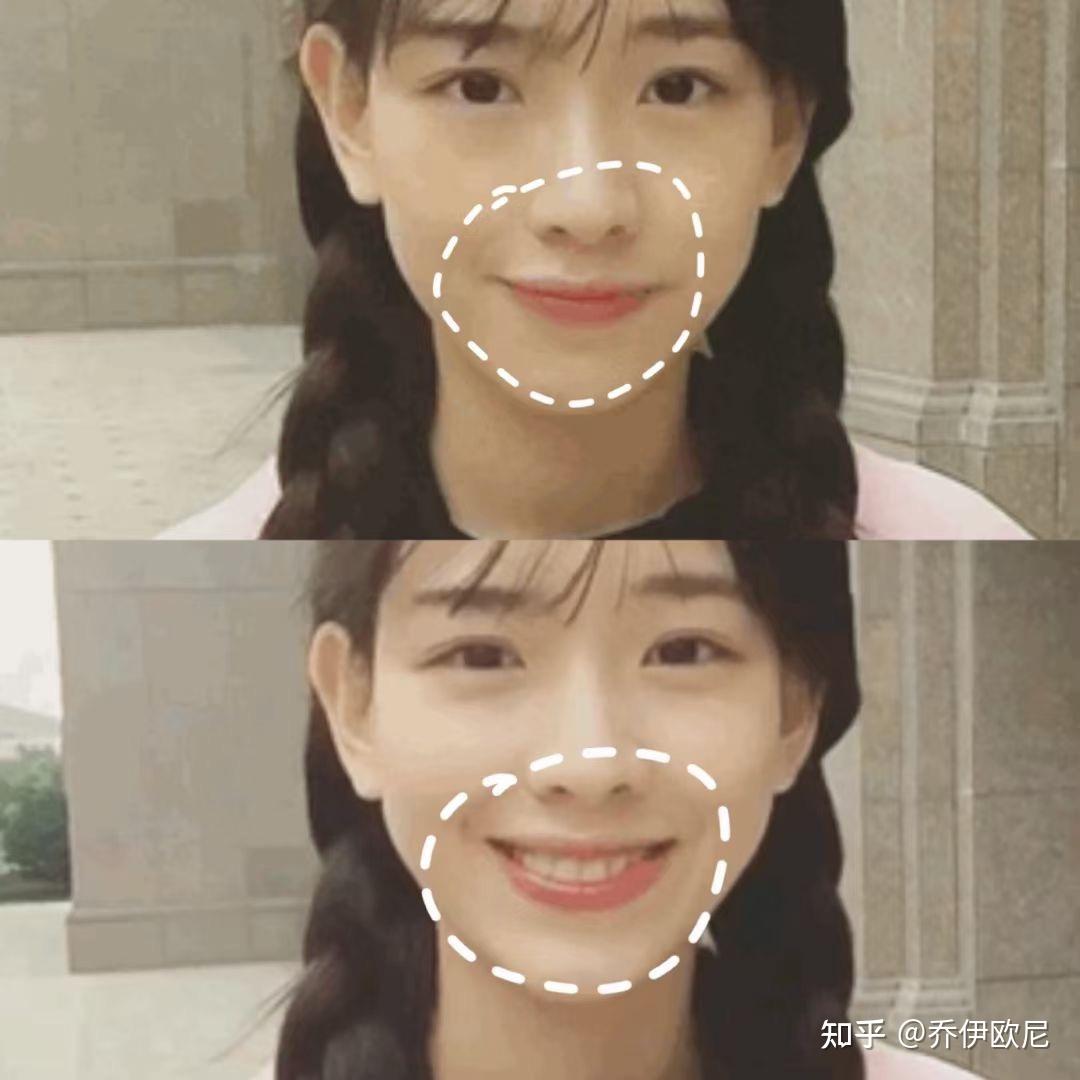 孙一宁做过哪些整形项目?do脸分析 - 知乎