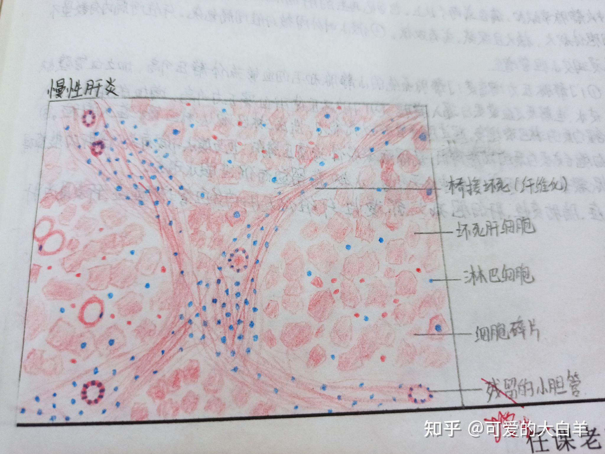 肾小管红蓝铅笔图图片