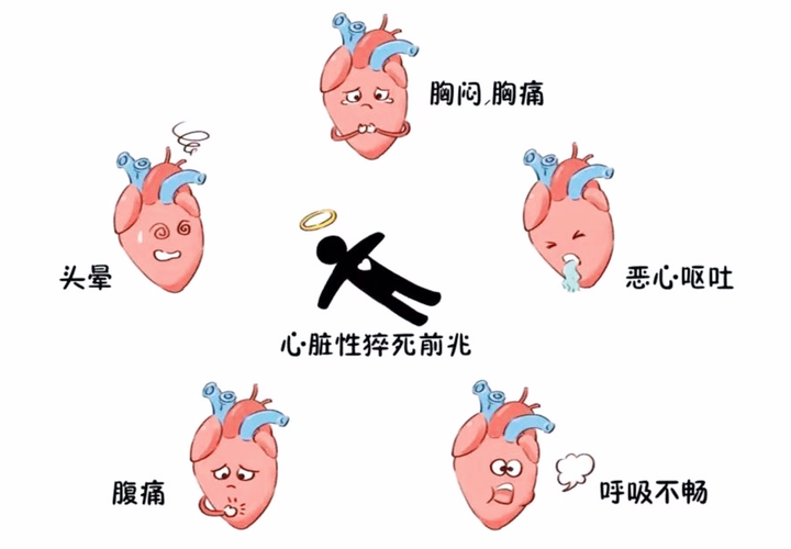 警惕!心源性猝死前,身体会发出这些SOS信号! - 知乎