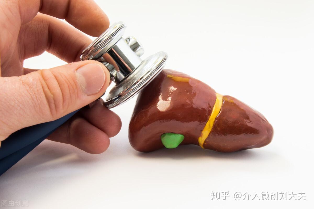 优先TIPS(P-TIPS)治疗肝硬化食管胃静脉曲张破裂大出血 - 知乎