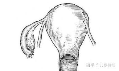 v2-5ba909cb24bee1d14fb81bf1ce7f8f9d_b.jpg