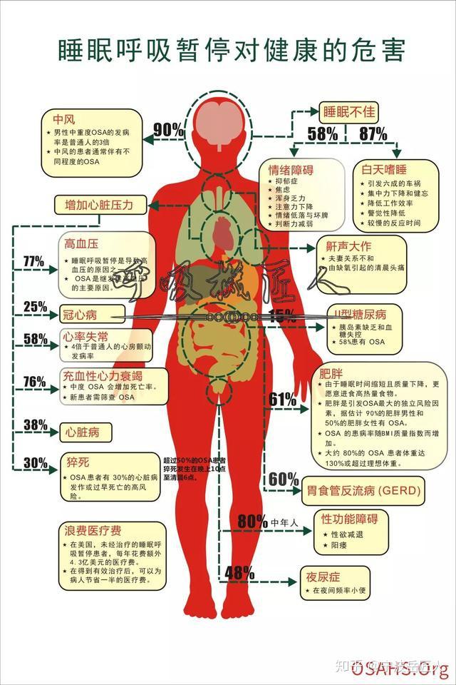 宁波小伙的白天嗜睡,一个小小的睡眠呼吸机轻松解决了!