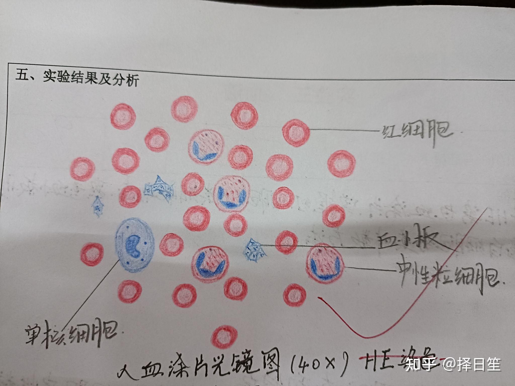 中性分叶核粒细胞绘图图片
