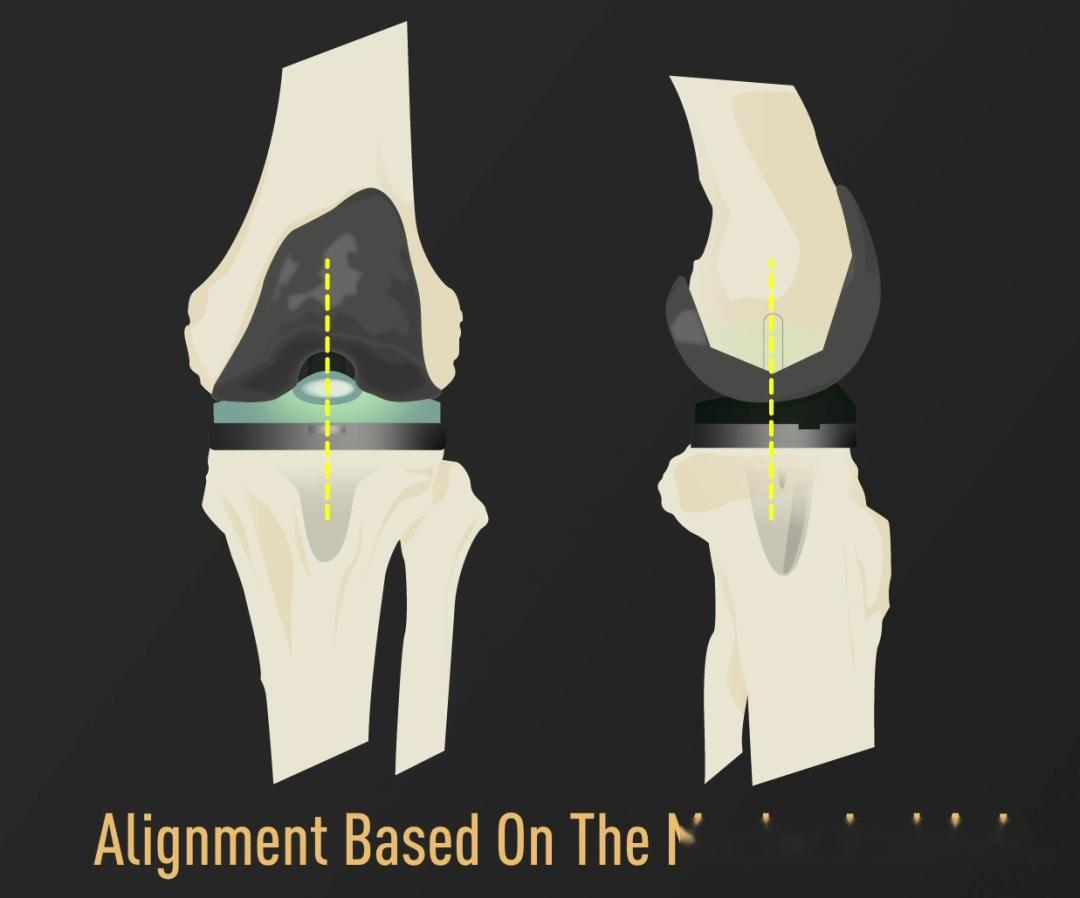 重量仅200克！手持式导航器械 知乎