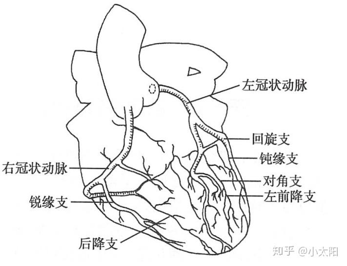 回旋支PCI术图片