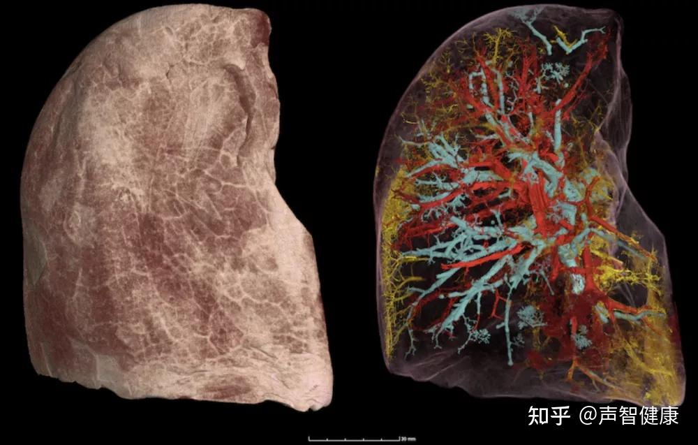 新冠治好了肺部图片图片