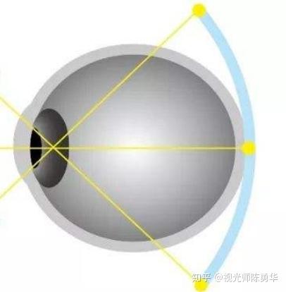 “离焦”是怎么回事? - 知乎