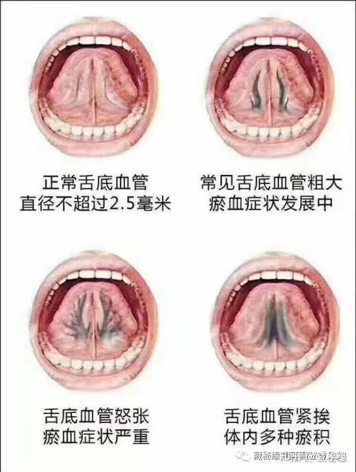 舌头重要血管分布图图片