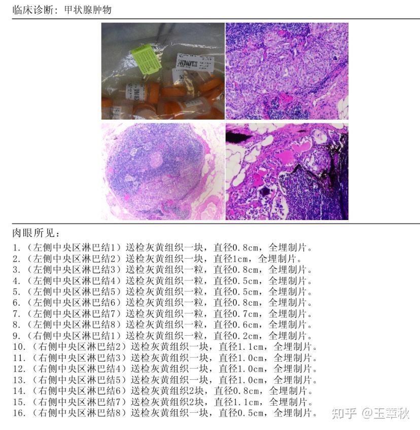 聊聊关于碘131二三事 - 知乎