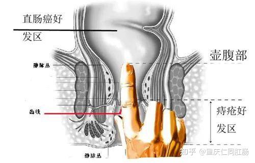 肛门是指哪里图片