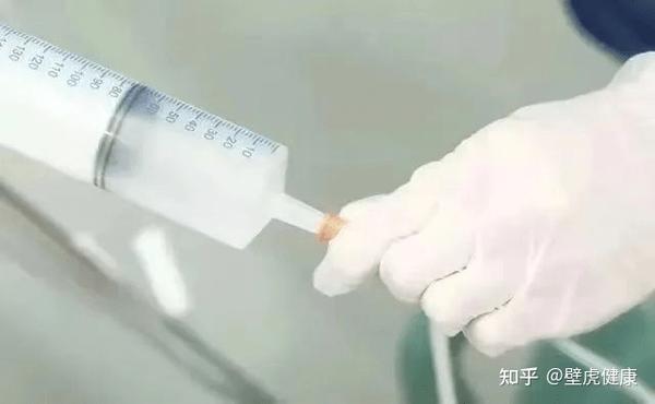 格尔护士：如何做好长期“留置胃管”患者的居家护理？ - 知乎