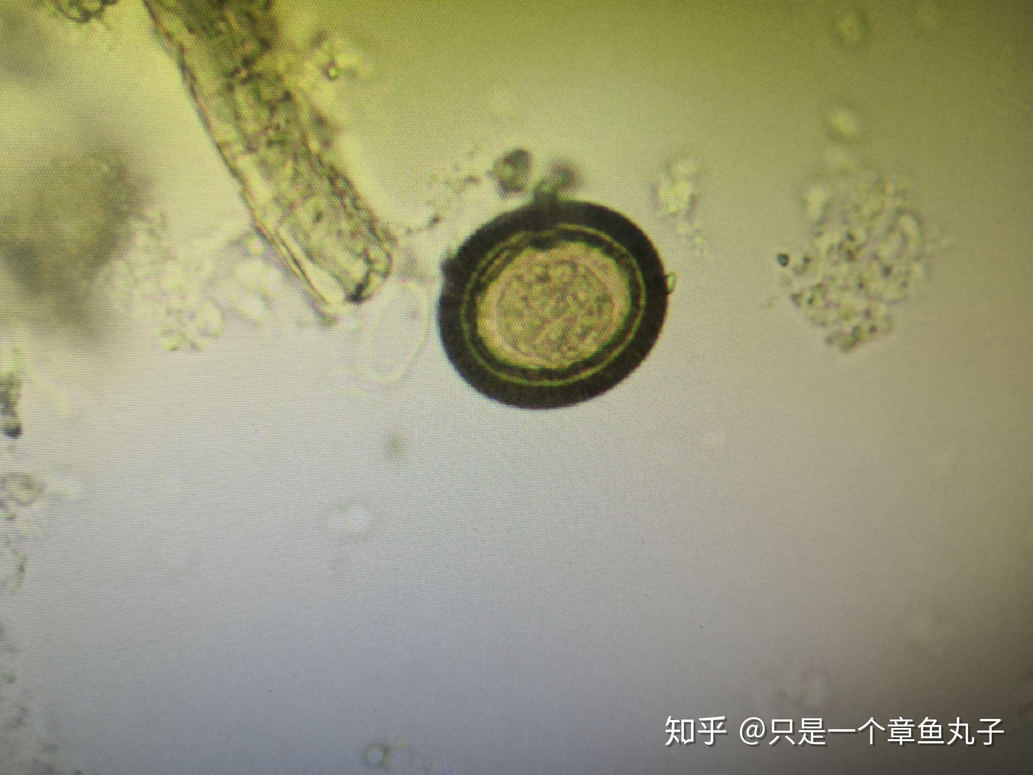 47.弓形虫滋养体(姬氏染色)-特种医学-医学