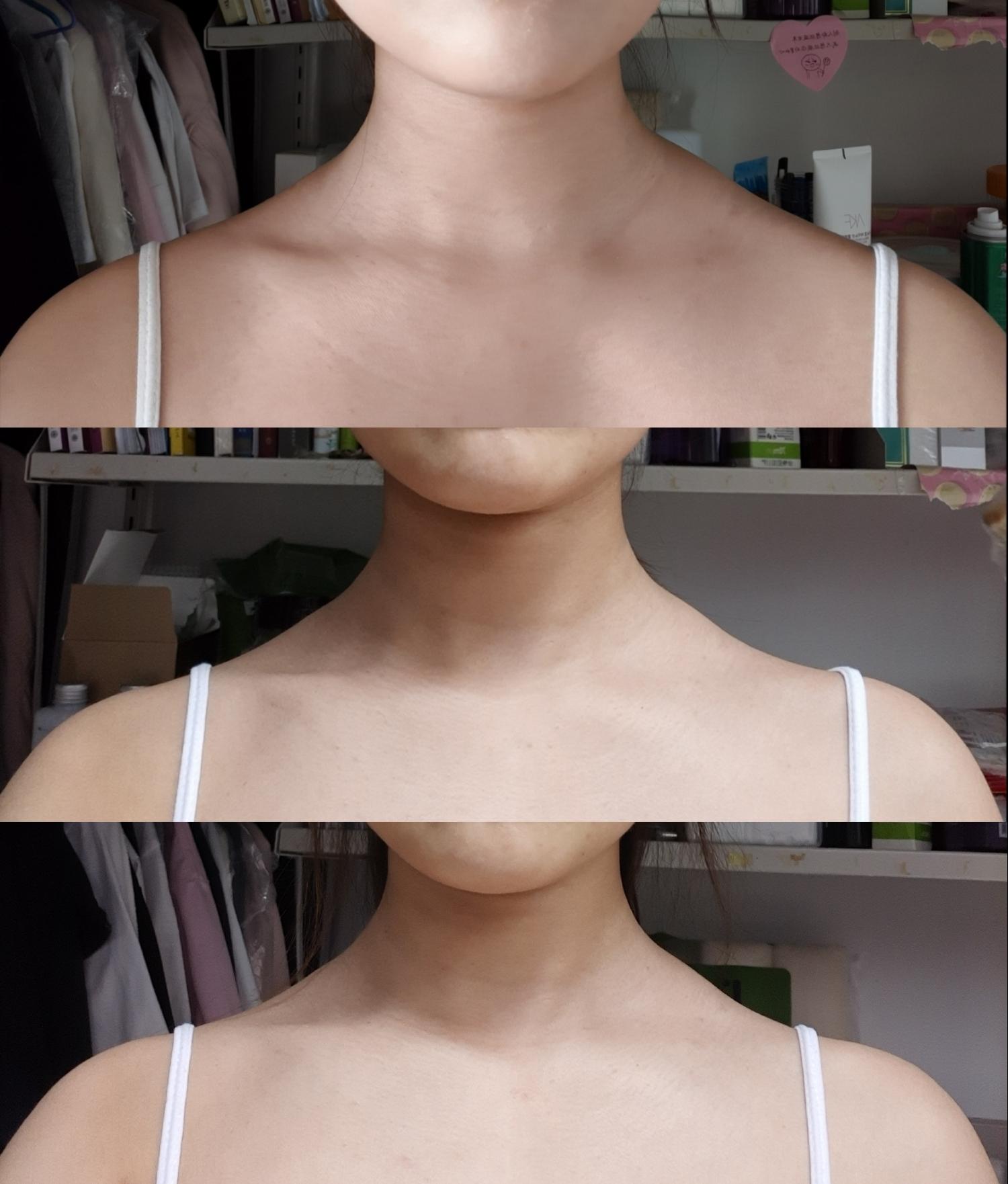 女生斜方肌怎么消除