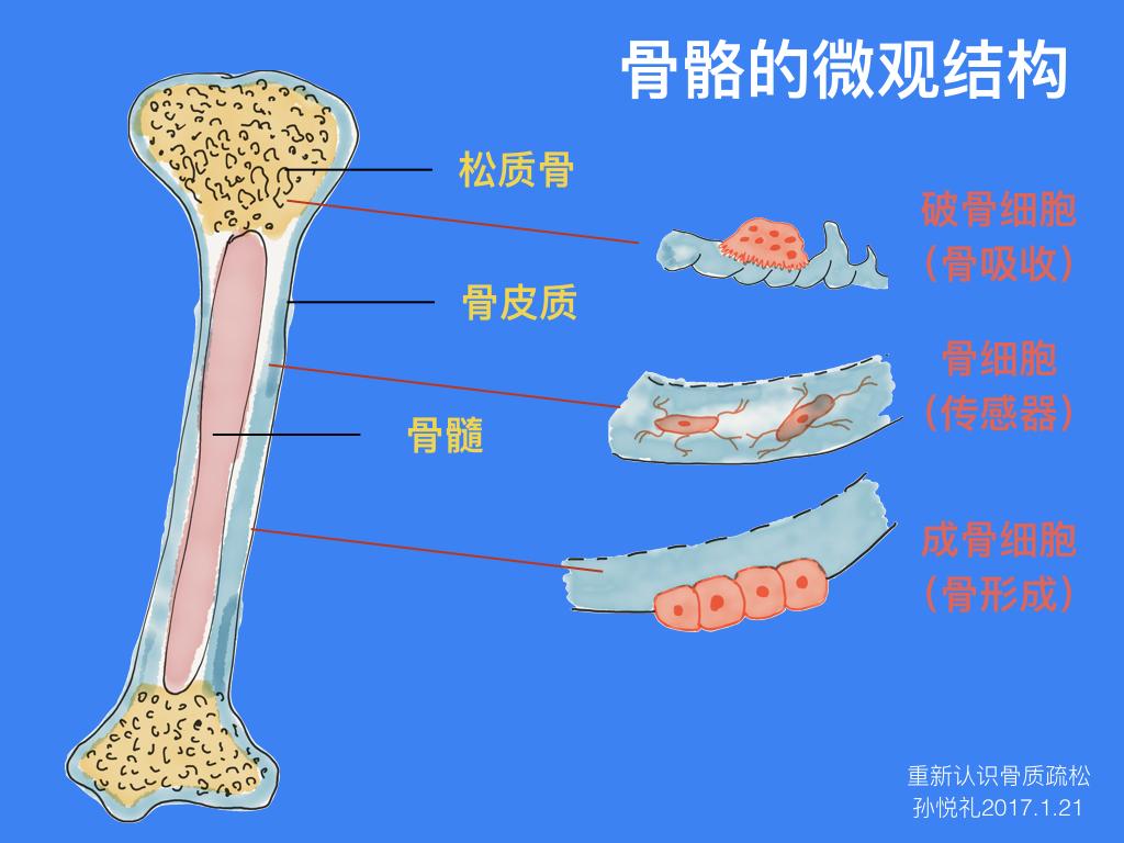 骨皮质松质骨示意图图片