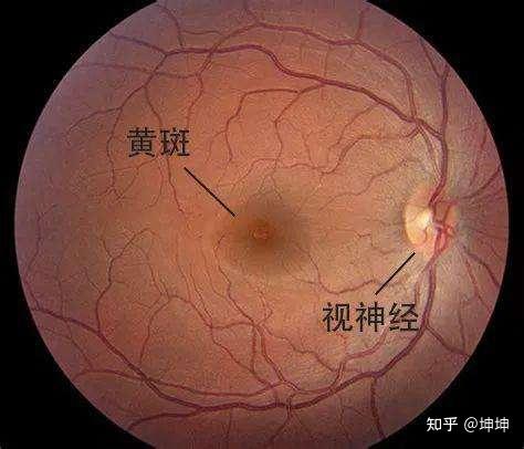 为左眼视乳头(视神经处)淡粉色 形状:卵圆形竖卵圆形 视盘视杯比值0