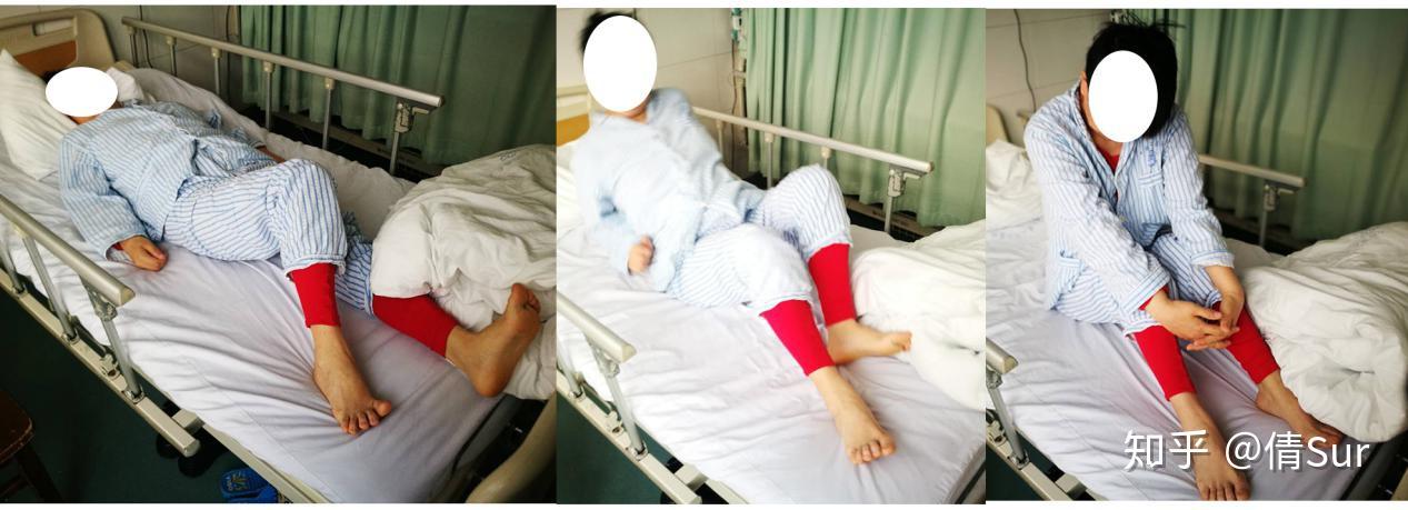 舞蹈病的dbs治疗及1例案例