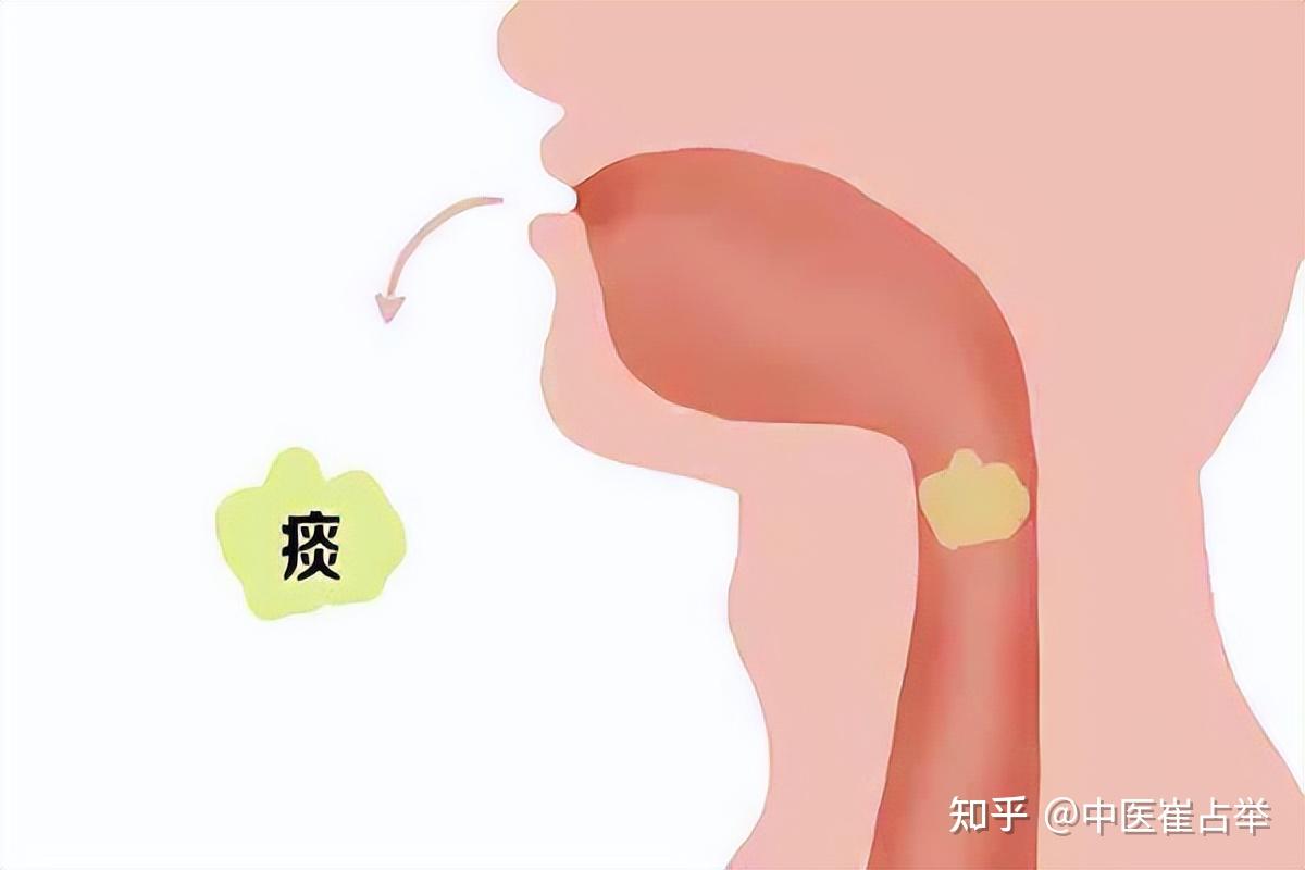 一补就上火,体内必有痰,一个中成药横扫痰湿,让你趁冬天补到位 - 知乎