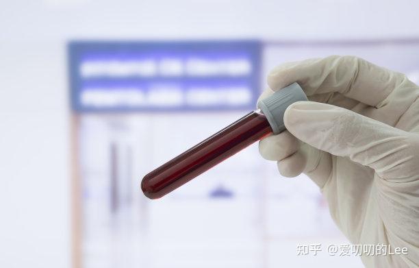 一文教会你简单判读血常规 - 知乎
