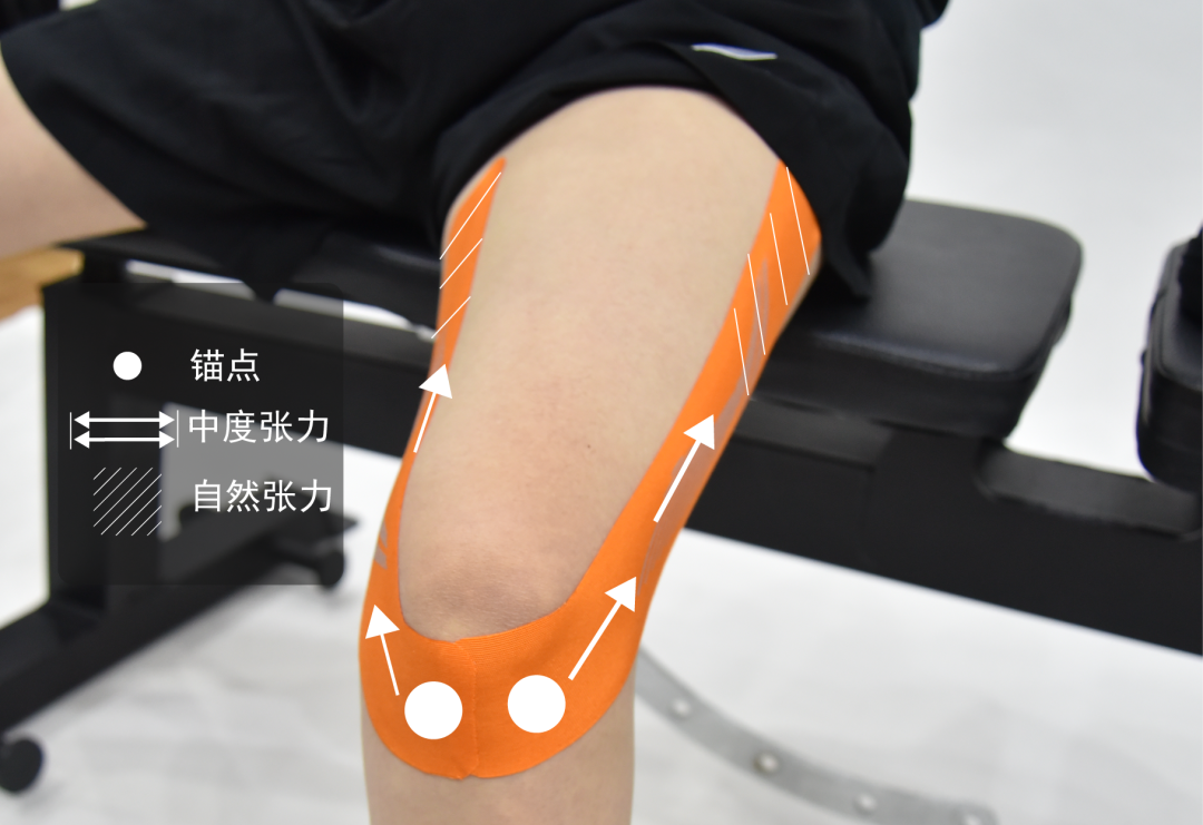 大腿内外侧紧绷疼痛,是很多跑者常见的问题,这个贴法运动前贴可以避免