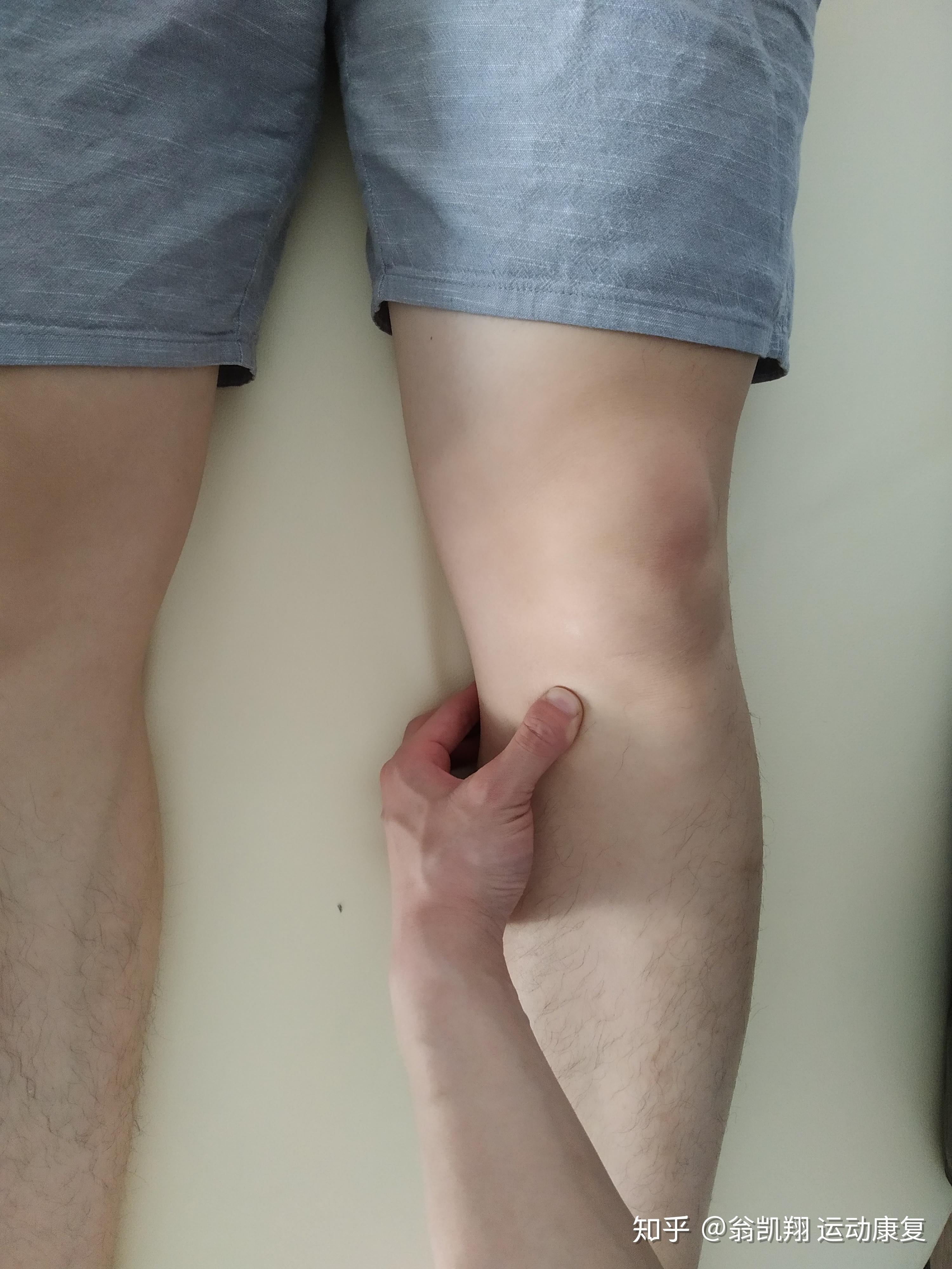膝关节后方疼痛图片