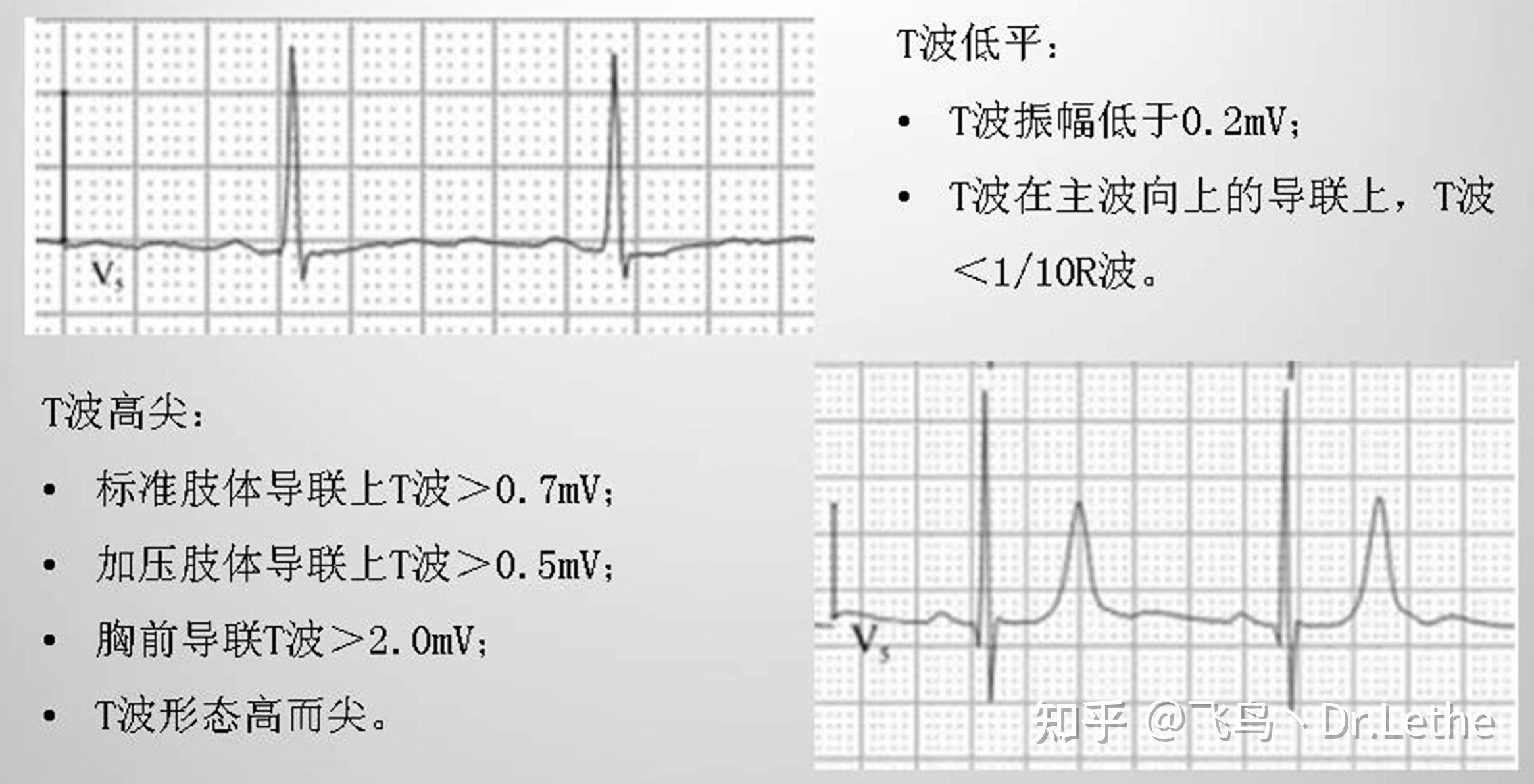 各波型,时段振幅及时限正常值范围