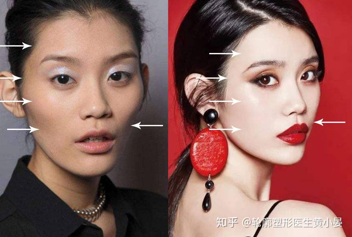 方脸逆袭效果:看下明星的脸型前后变化后的颜值提升效果:常见的问题