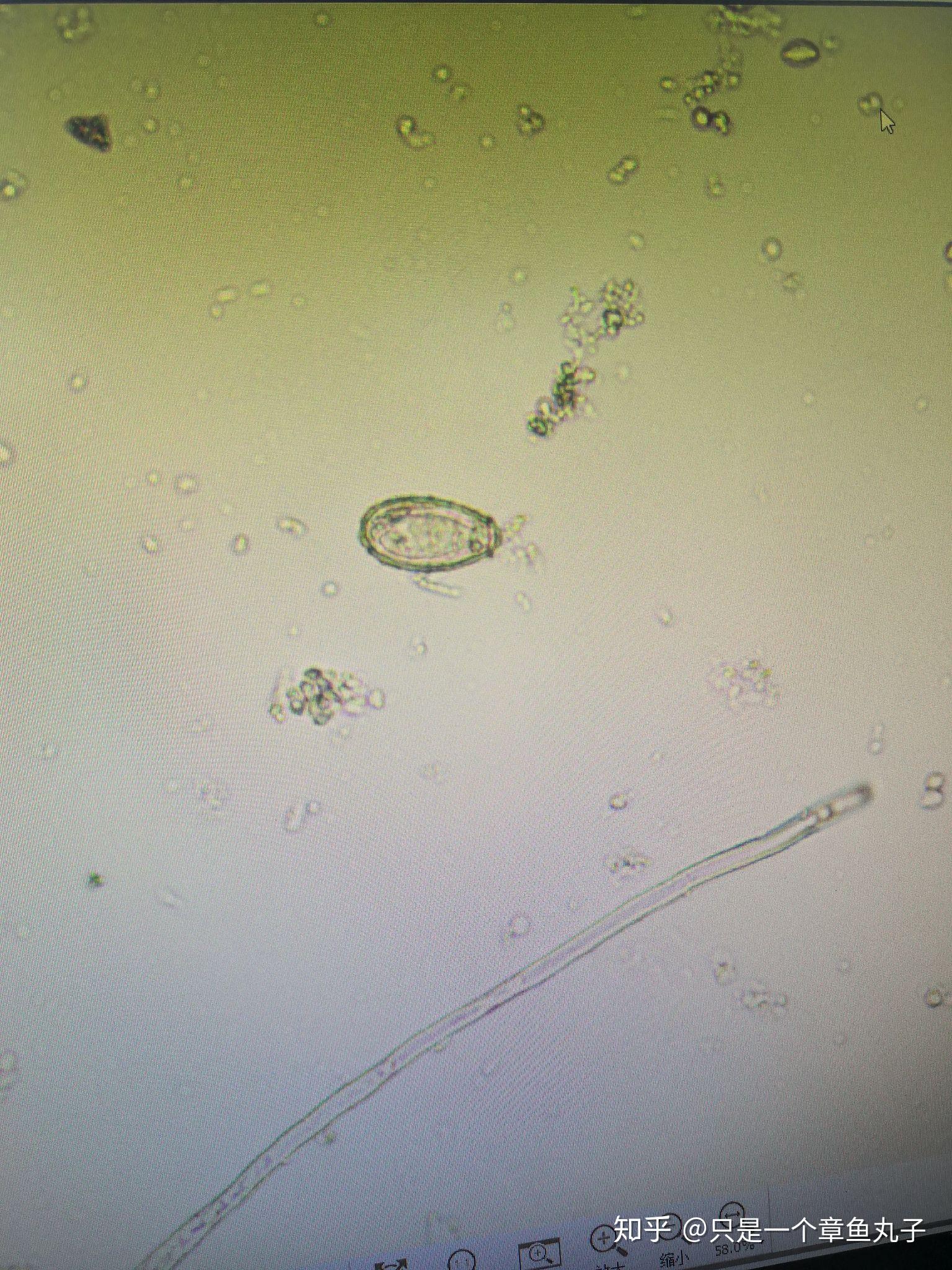 寄生虫部分显微镜下图