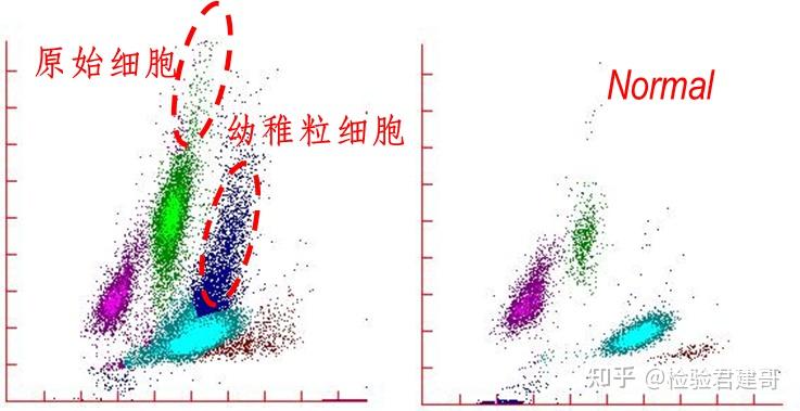 血常规散点图和直方图不会看?1 分钟看懂 12 种异常结果 - 知乎