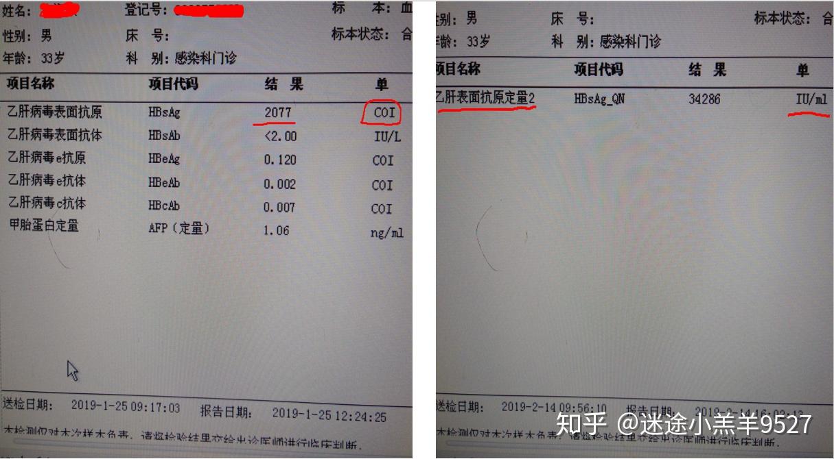 乙肝表面抗原多少正常图片