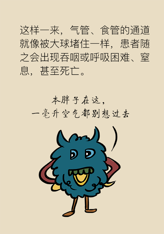 嗓子疼随便开点药就行当心别窒息了