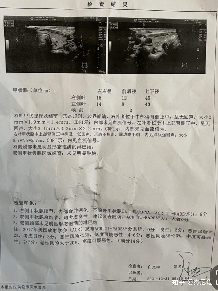 甲状腺恶性肿瘤甲状腺癌的记录