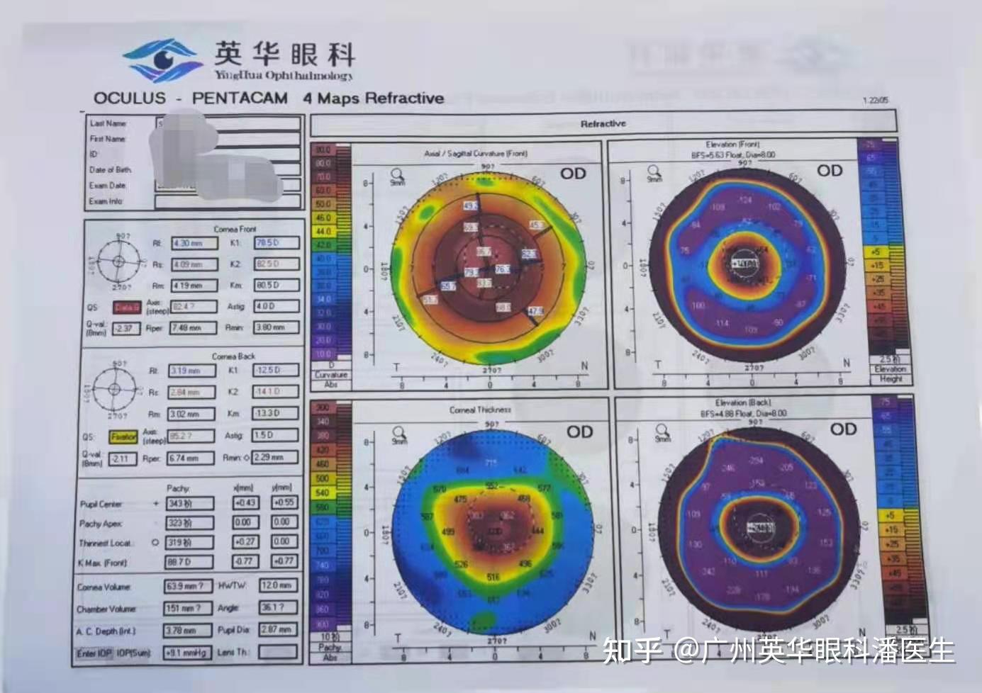 不求人丨教你2步看懂角膜地形图
