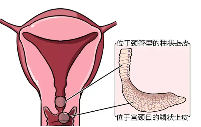 宫颈颗粒图片