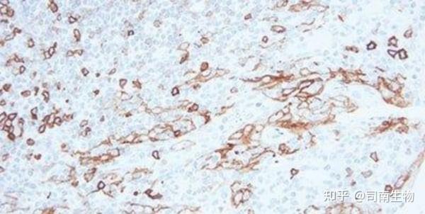 IHC 染色实践指南 - 知乎