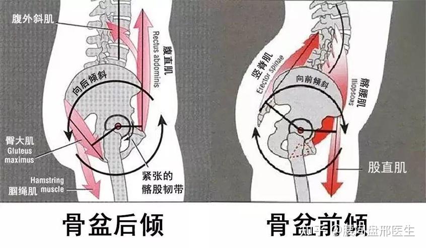 你身边有膝前痛脂肪垫炎的朋友吗