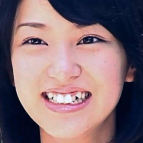 为什么日本人的牙齿这么丑? 
