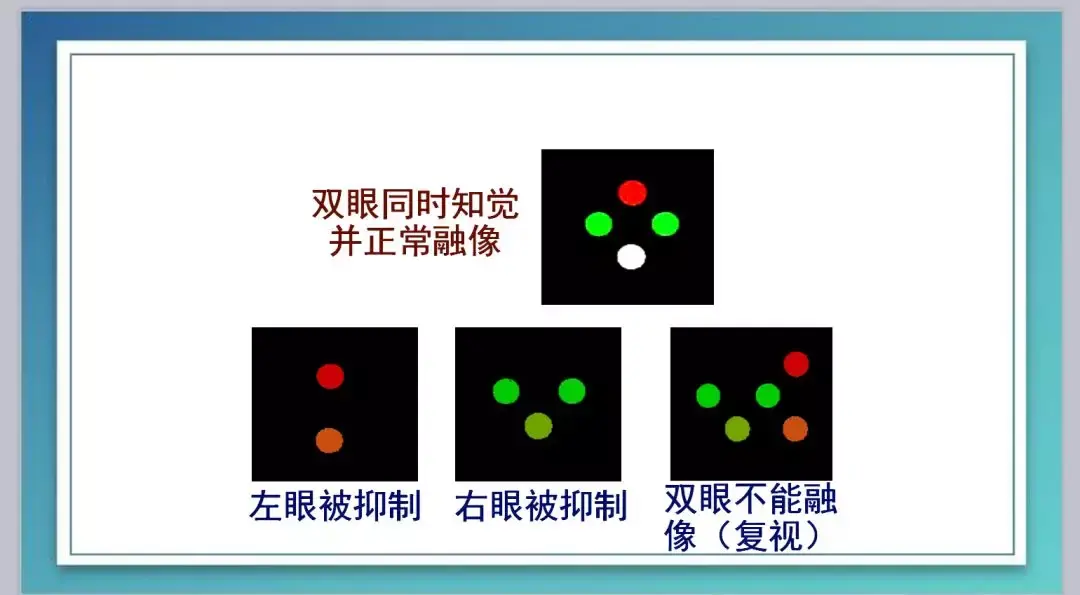 檢查顧客的立體視覺的敏銳度,初步診斷雙眼是功能是否正常.