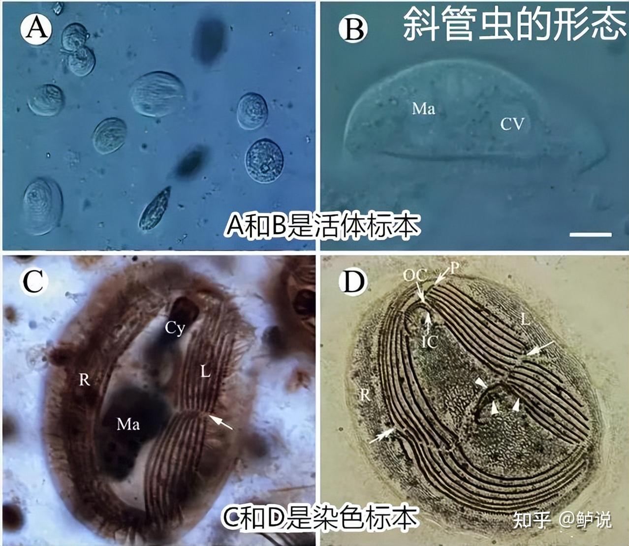 显微镜下的斜管虫图片