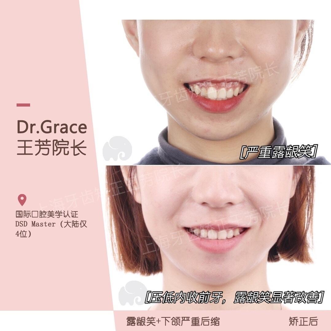 v2-5f258c2b5cb779d68ea840b6bf43ac55_1440w.jpg?source=172ae18b
