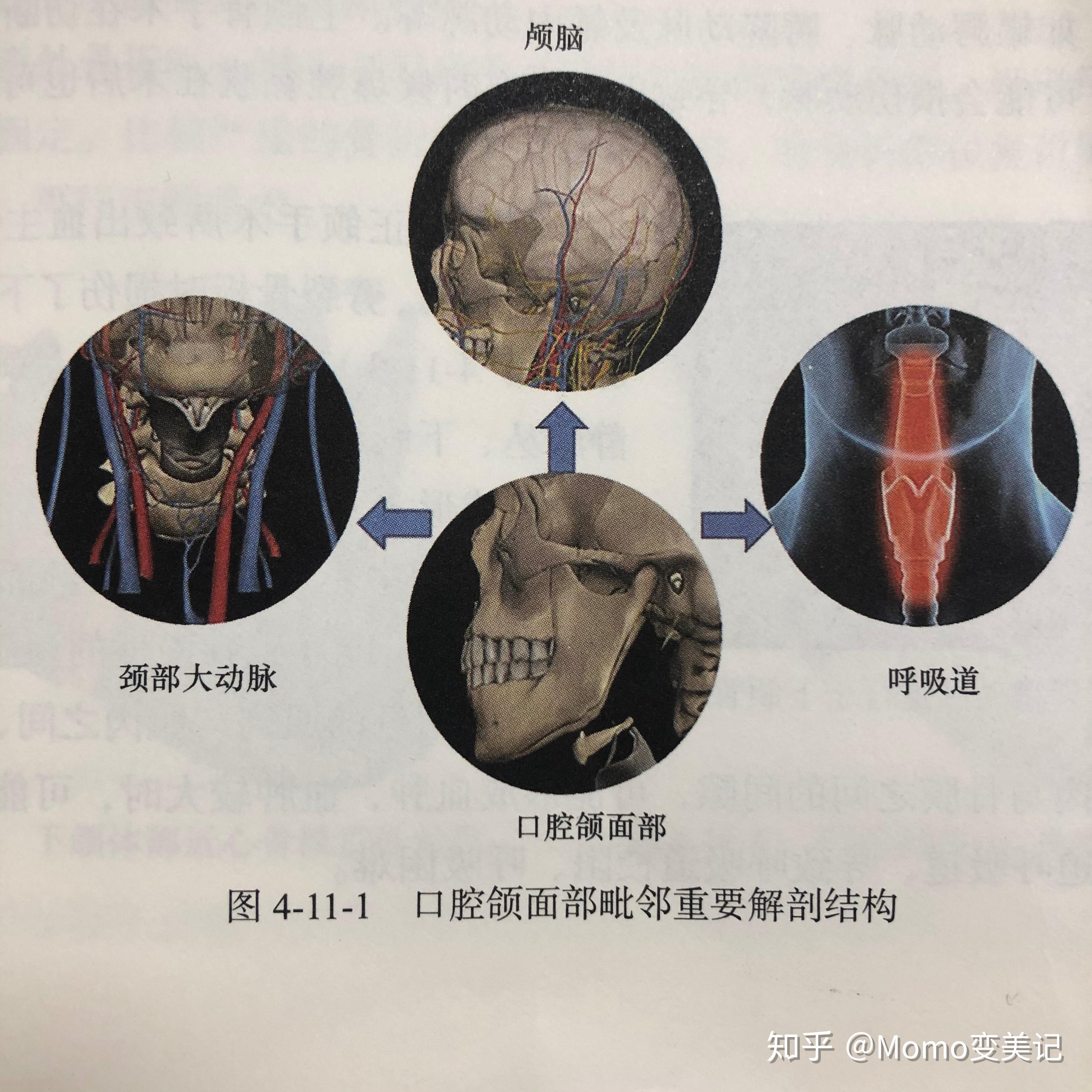 正颌手术有哪些常见的风险和并发症? - 知乎