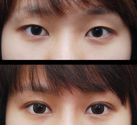 怎么才能有双眼皮大眼睛 v2-5f31bb39b63b37c51129b91281480f8f_r.jpg