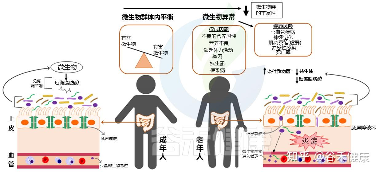 肠道微生物群与膳食多酚互作对人体健康的影响