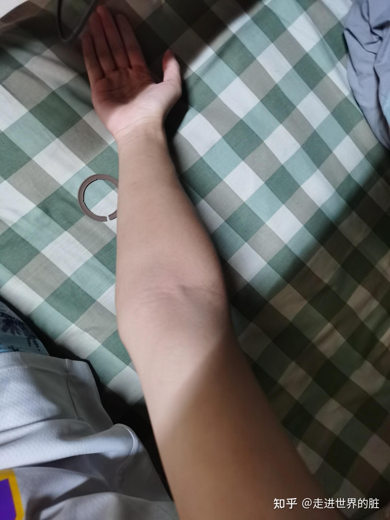 兄弟们帮忙看一下这个是肘外翻吗