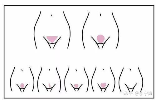 比基尼脱毛?这些知识你需要了解 - 知乎