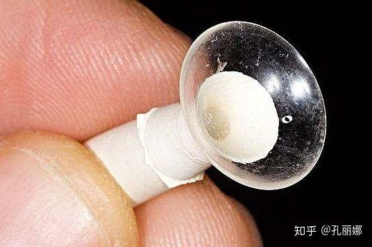 隐形眼镜沉淀物及影响